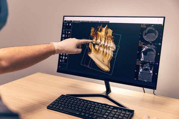 Cone Beam x-ray at Gary Mangieri, DMD 